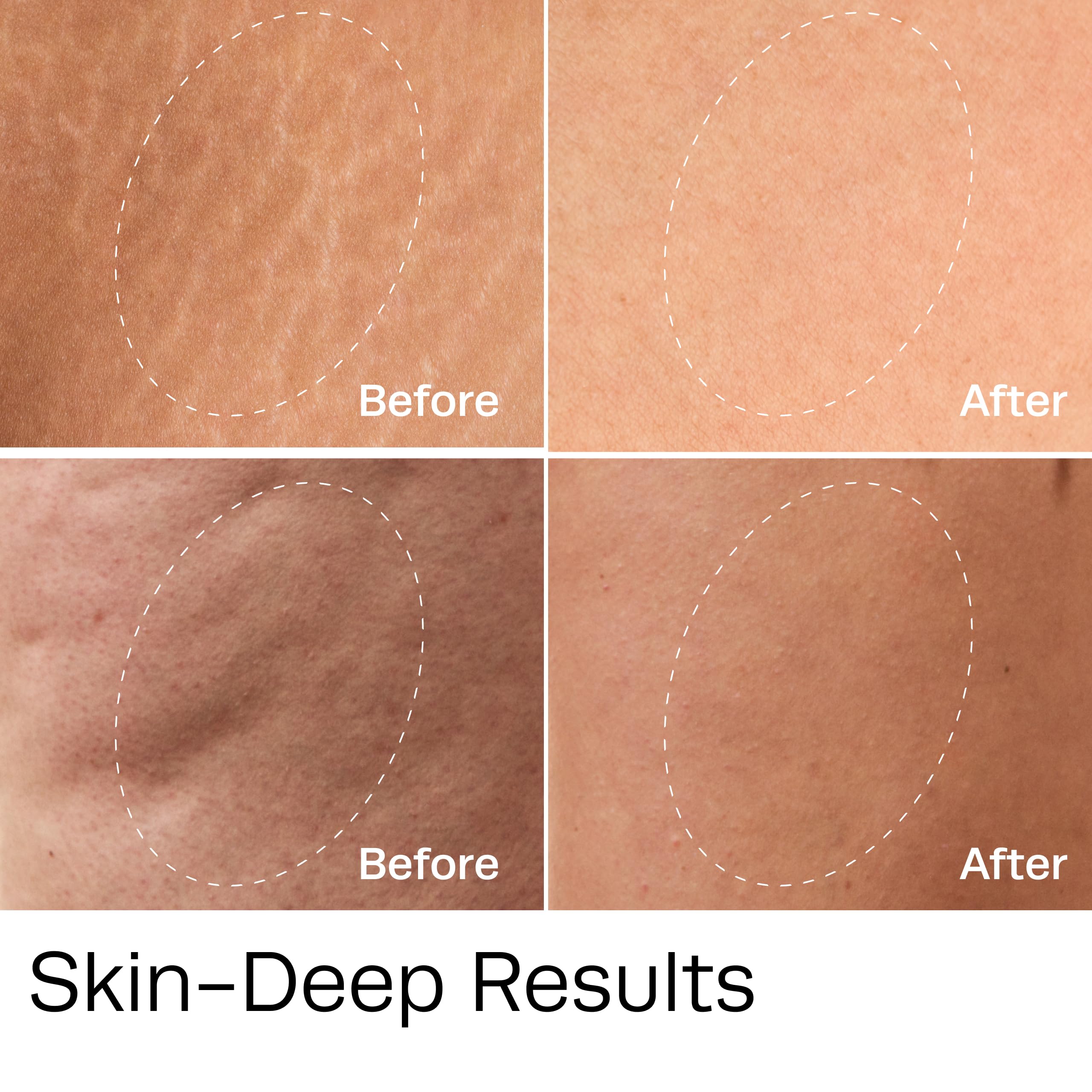 Legs after applying Hot Vita Vitamin C Body Oil with hydration and glow.