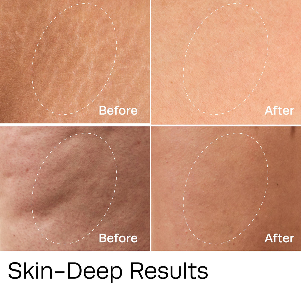 Legs after applying Hot Vita Vitamin C Body Oil with hydration and glow.