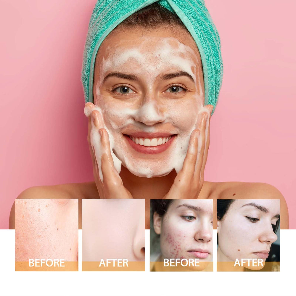 HOYGI turmeric cleanser boosts clean pores and refreshed skin after use.