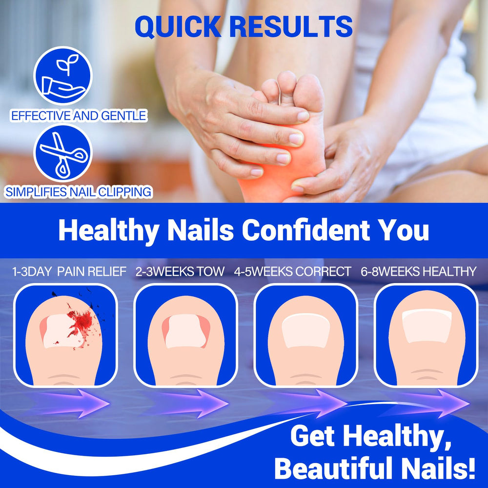 HULEIWA 2-pack ingrown toenail drops kit shown with bottles