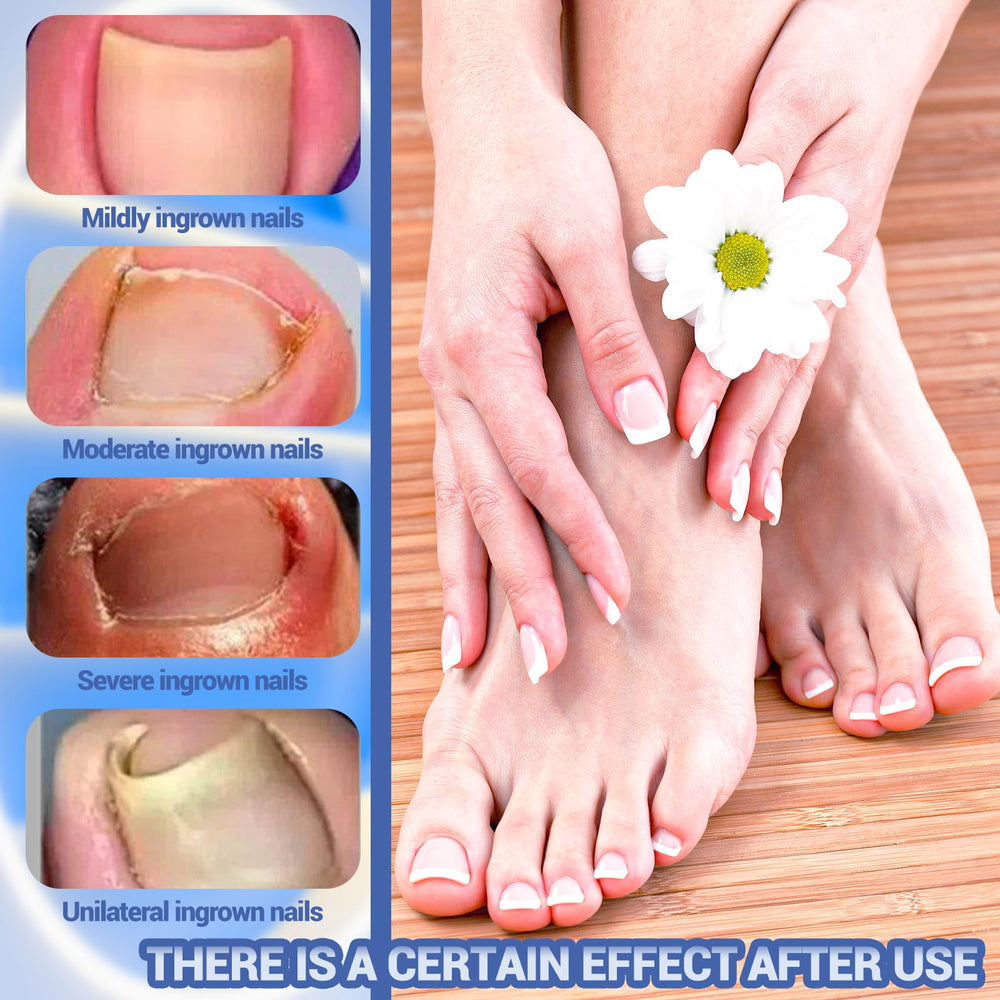 80-patch set with file included for versatile nail sizes and shaping