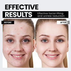 Five level current adjustment for customized, comfortable sessions
