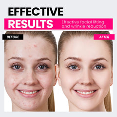 Hunvva V-shaped face contouring for a defined profile