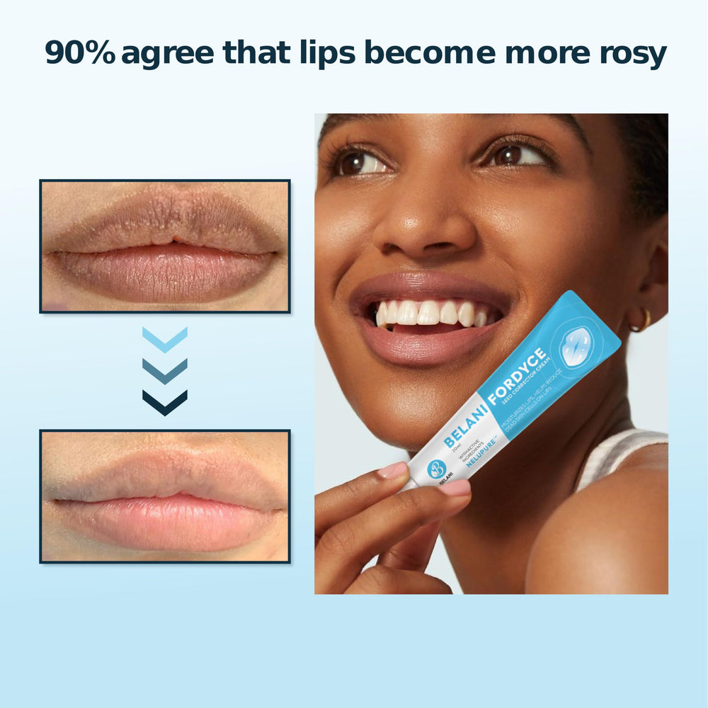 HVSun Belani Fordyce Cream application on lips for smooth finish