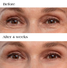 Hyaluronic Acid Collagen Micro Patches dissolving nanodarts visible, delivering actives to the eye area.