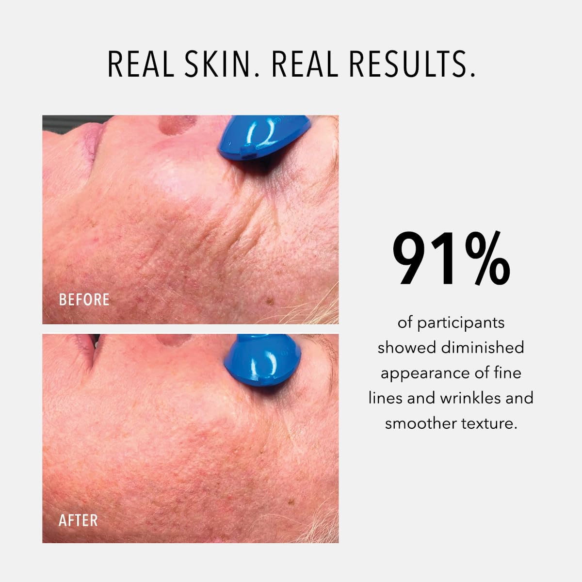 HydroPeptide Nimni Cream packaging display emphasizing premium, science-backed skincare.