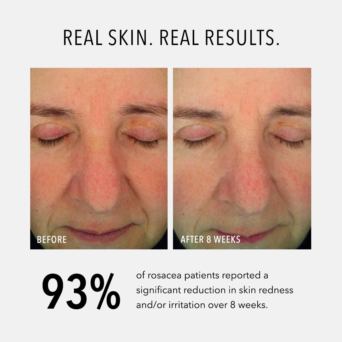 HydroPeptide Soothing Serum swatch on skin demonstrates smoothing effect.