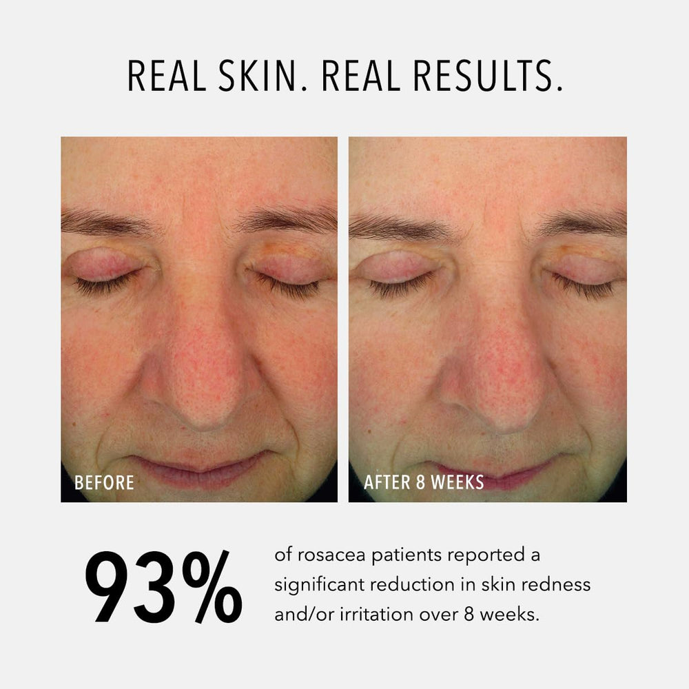 HydroPeptide Soothing Serum swatch on skin demonstrates smoothing effect.