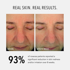 HydroPeptide Soothing Serum swatch on skin demonstrates smoothing effect.