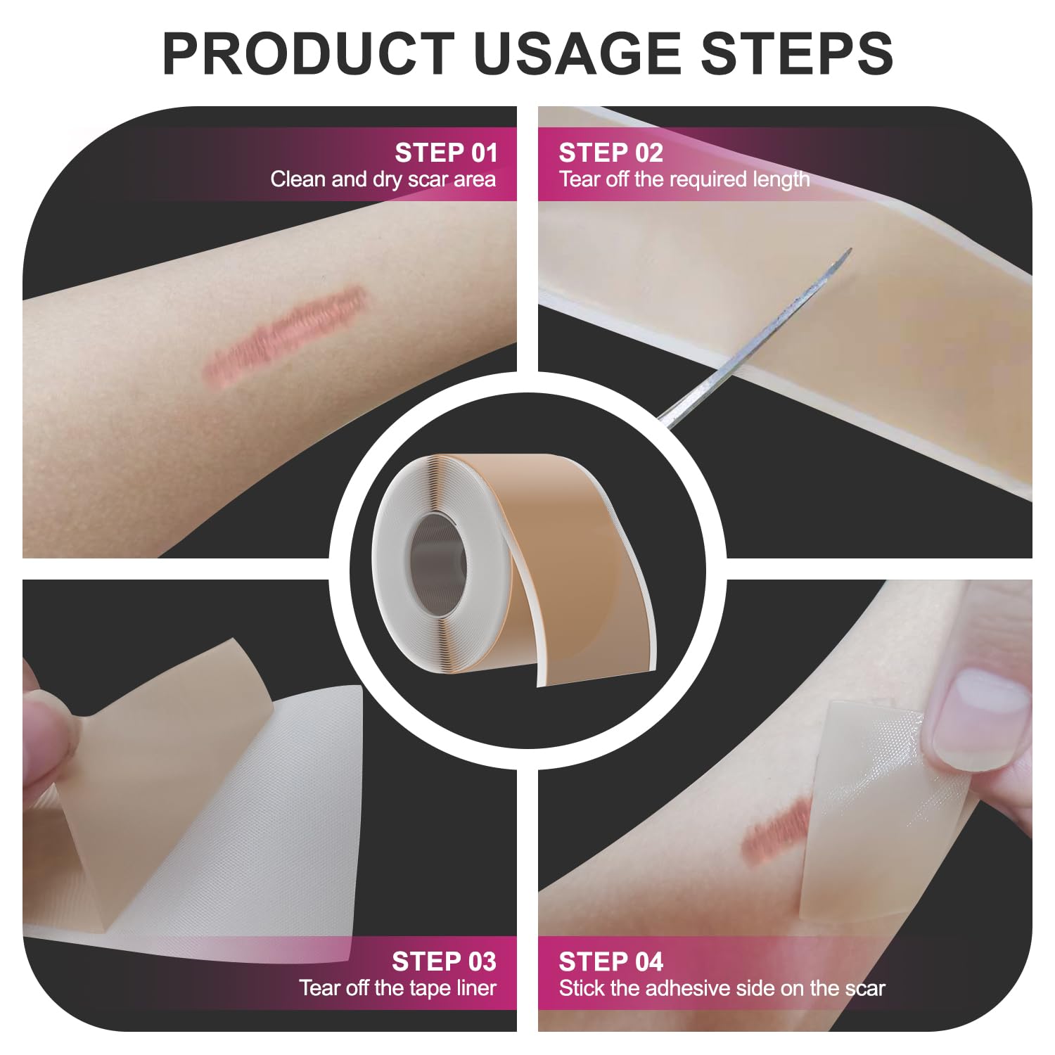 Hysimedy silicone scar tape with soft liner for easy application.