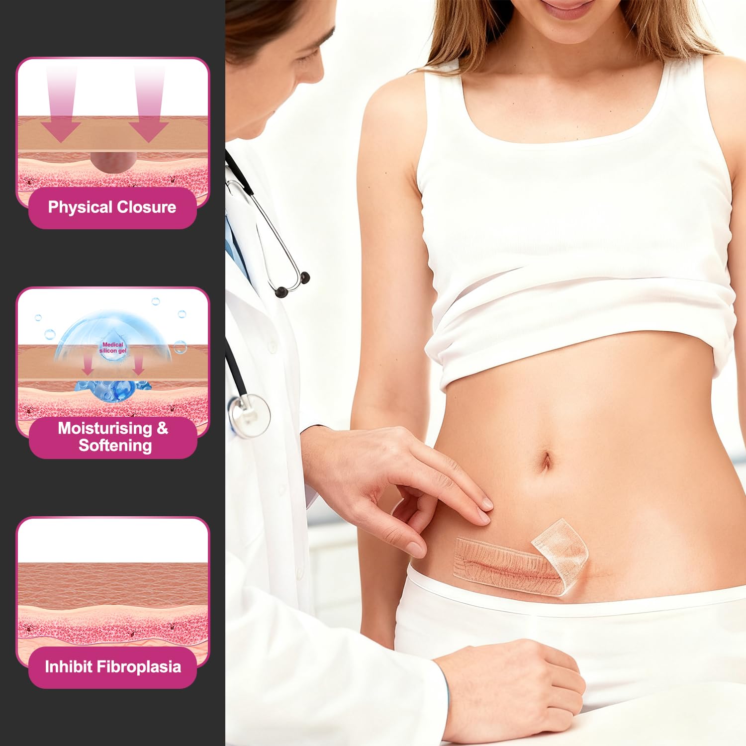 Hysimedy scar tape for facial wrinkles around scars for subtle smoothing.