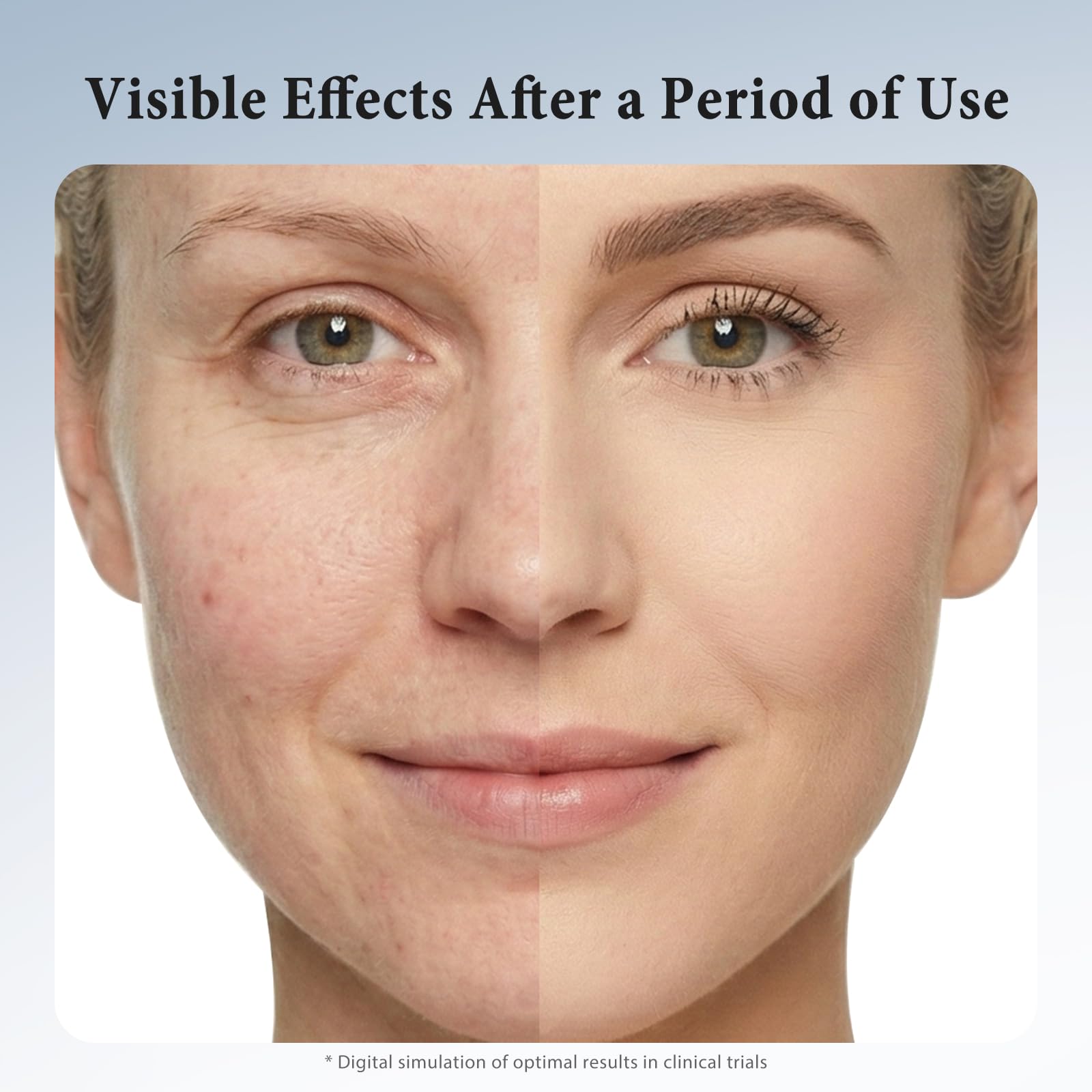 Hyuxeo Retinol Serum delivers 24-hour hydration on the skin surface