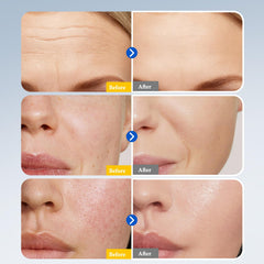 Hyuxeo Retinol Serum close-up highlights improving skin elasticity potential