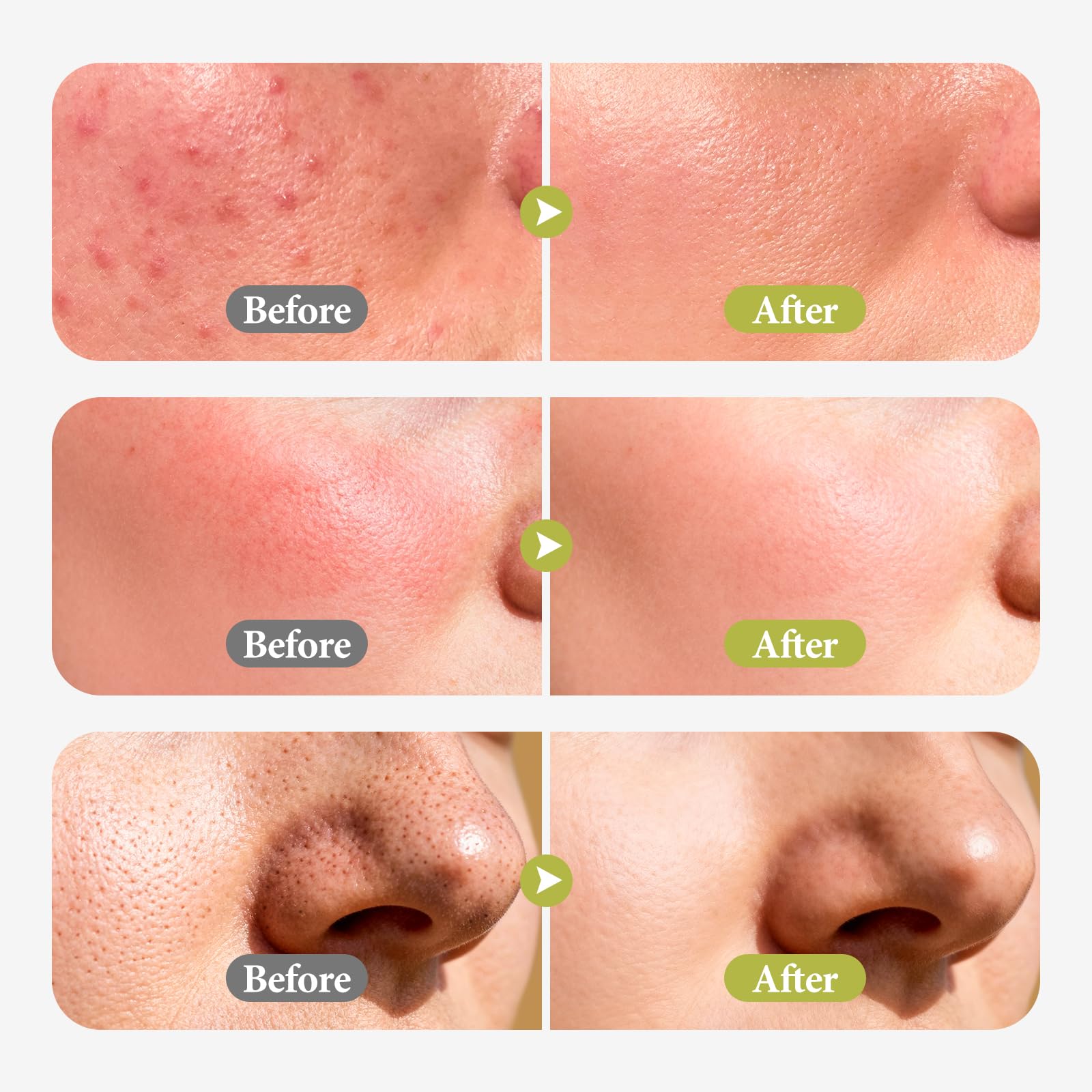 Hyuxeo hydration film delivers lasting moisture