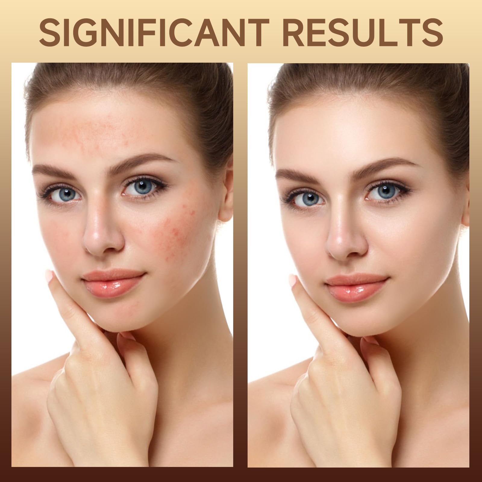 Unscented formula visible on HZENPPOR PDRN Serum Cream.