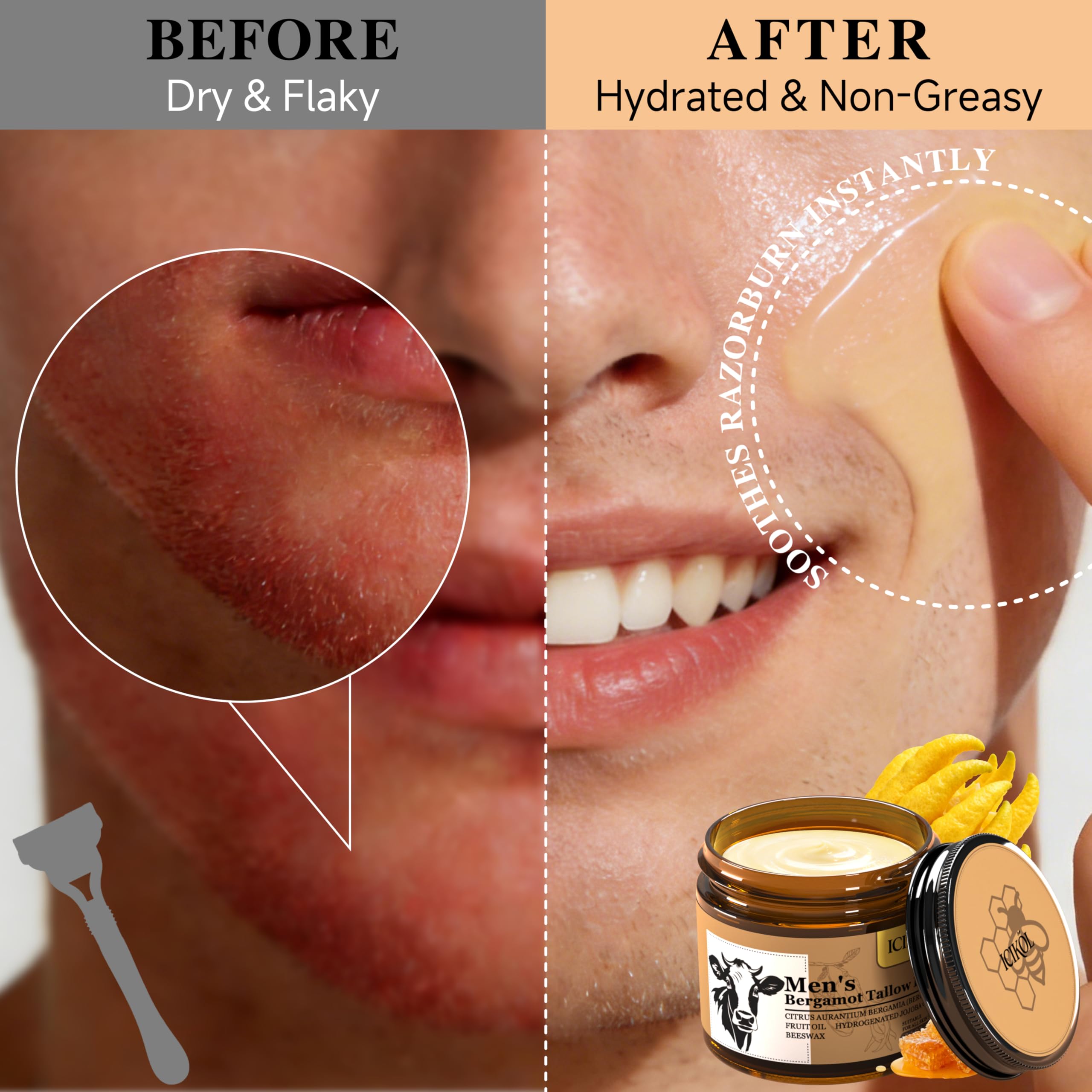 ICIKOL balm after shaving soothing dry skin without alcohol sting.