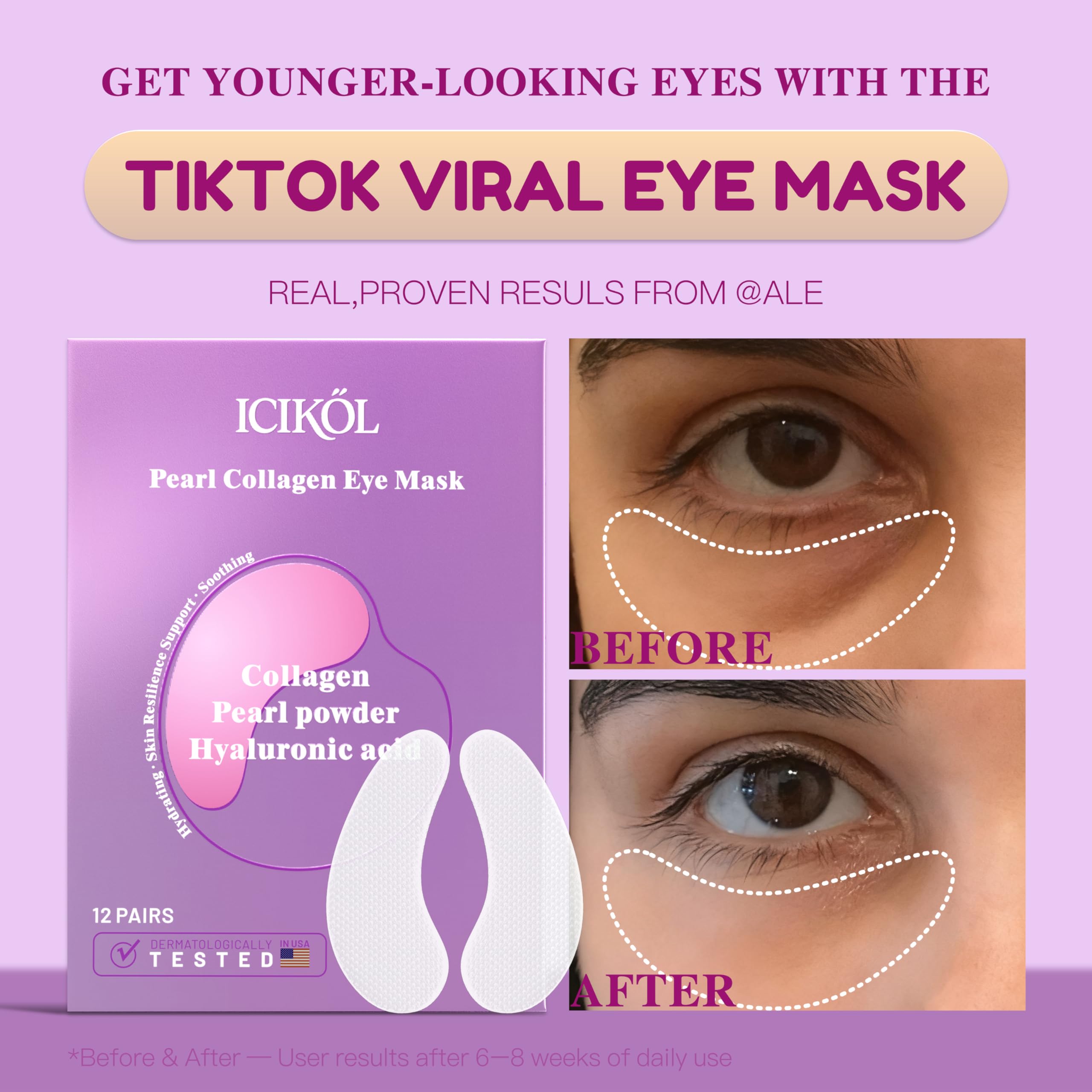 ICIKOL collagen under eye patches during absorption for depuffing