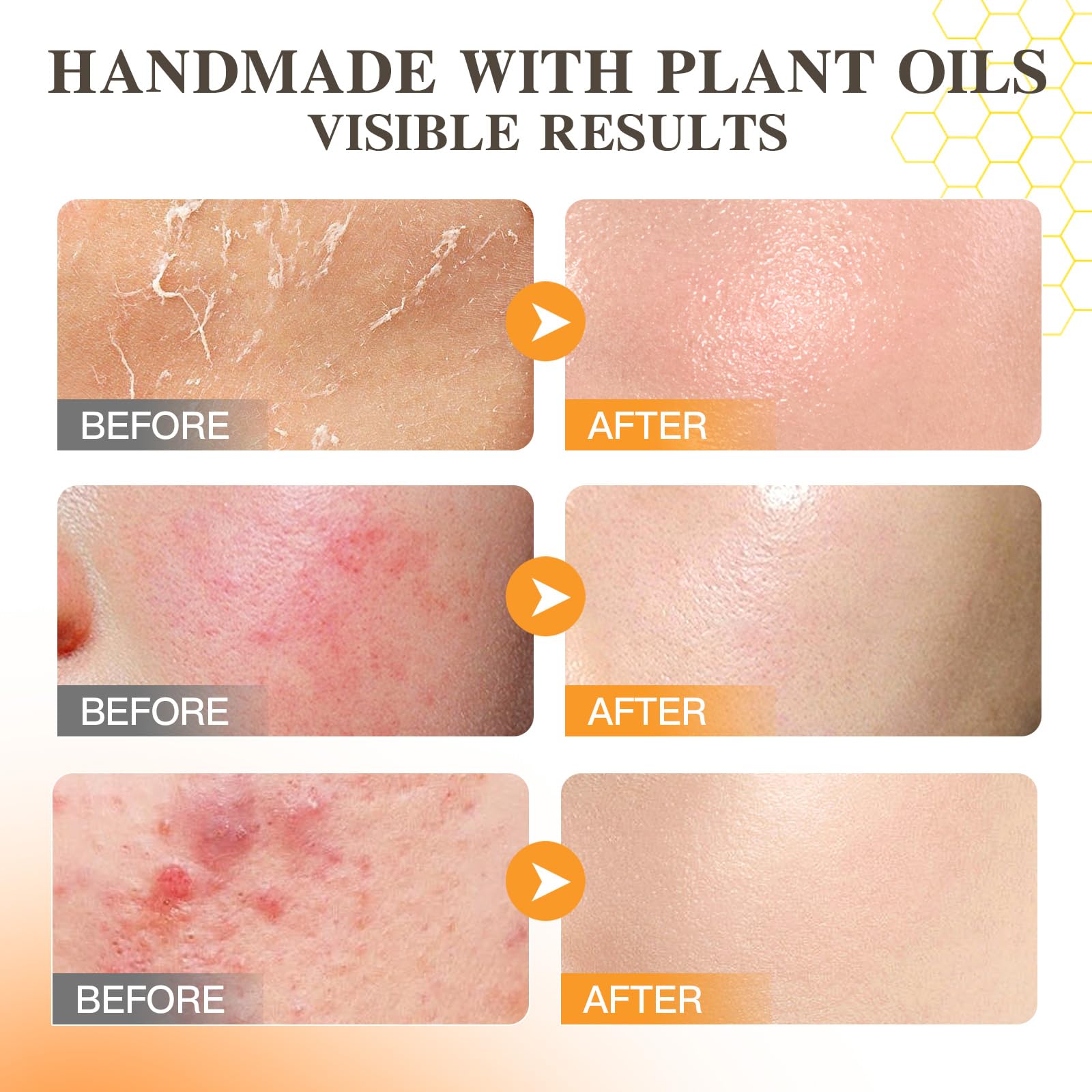 ICIKOL Face and body moisturizer application shot with non-greasy finish.