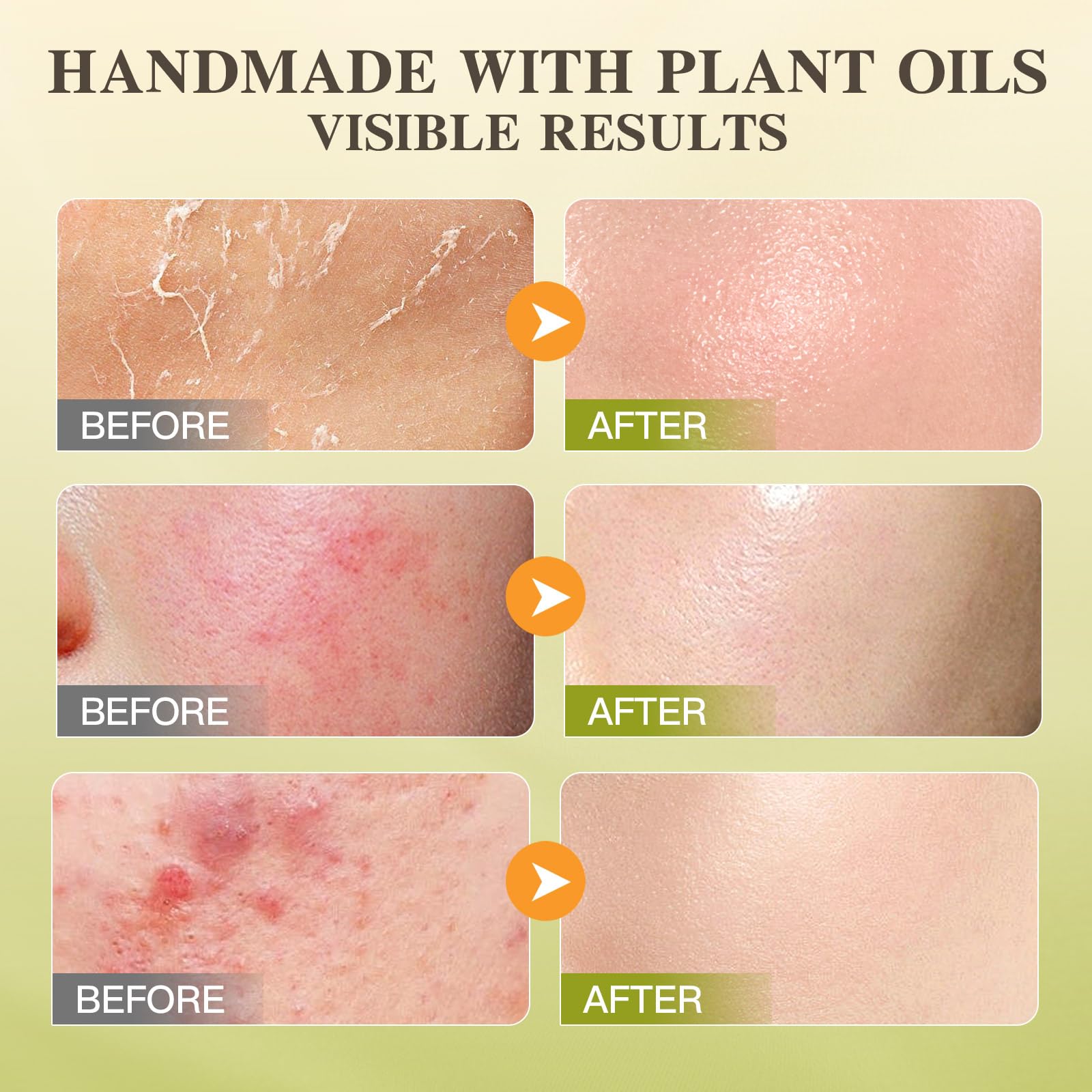 ICIKOL hand and body moisturizer for daily use.
