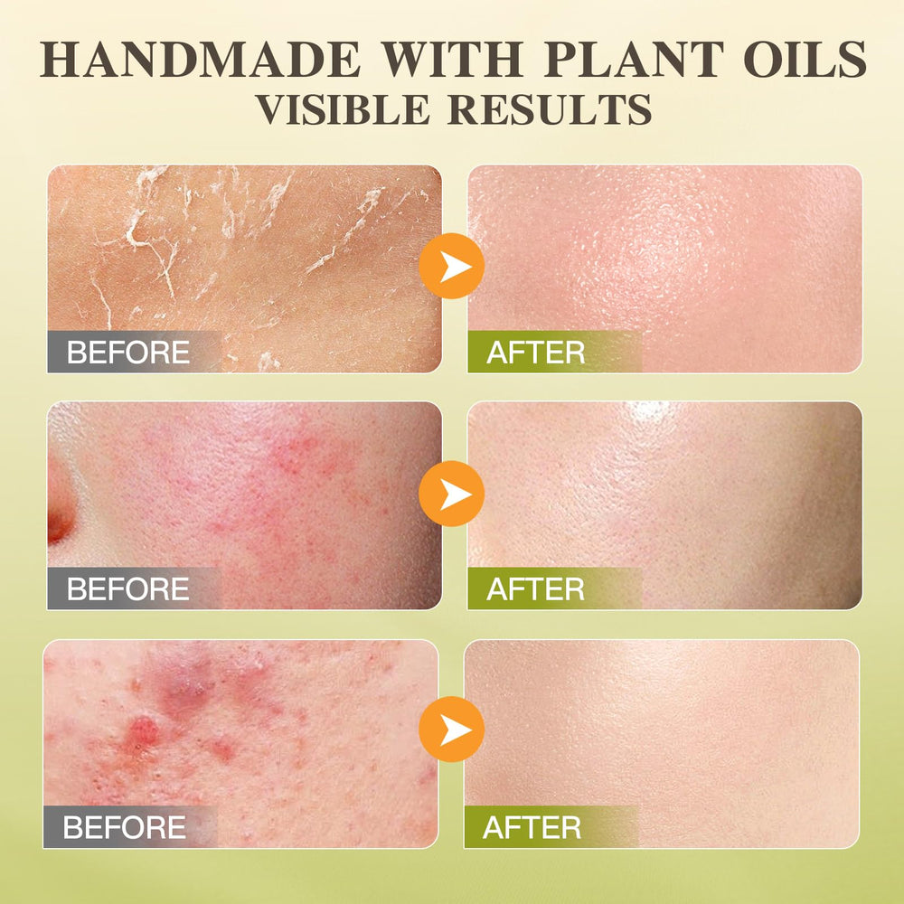 ICIKOL hand and body moisturizer for daily use.