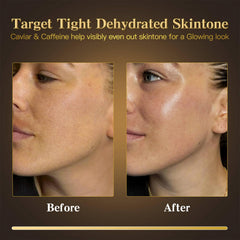 ICIKOL real 24K gold and caviar essence softens fine lines
