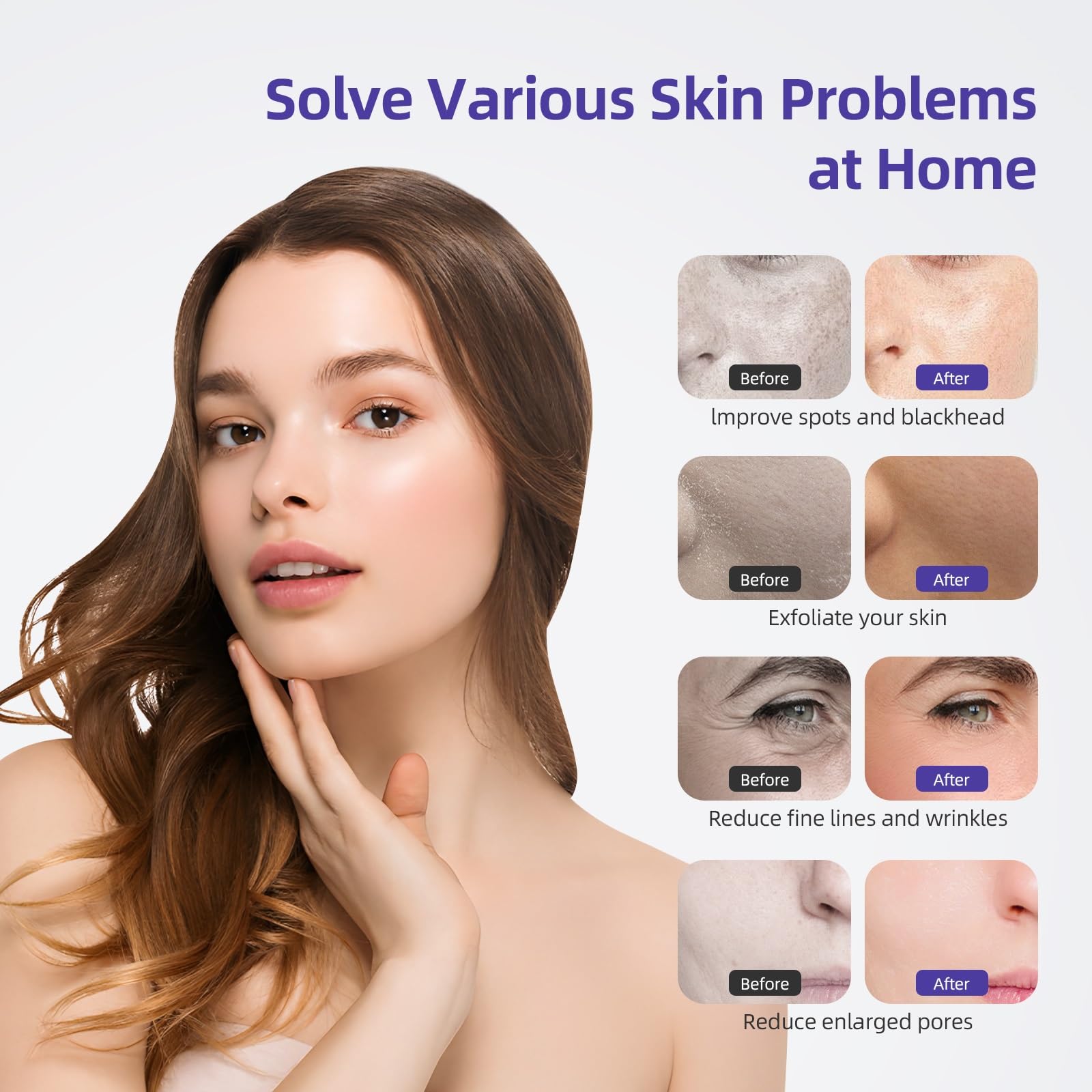 IeBilif 9-diamond-heads kit enables versatile exfoliation across facial zones