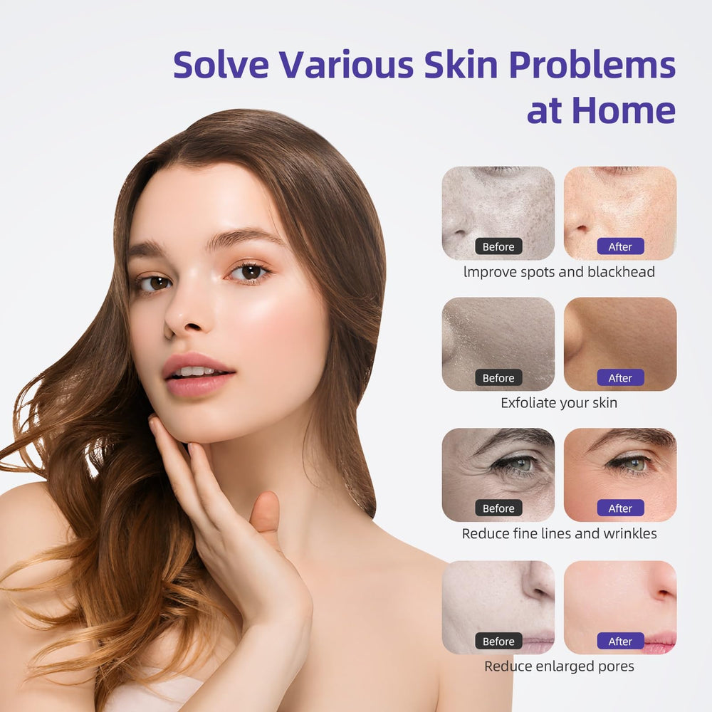 IeBilif 9-diamond-heads kit enables versatile exfoliation across facial zones