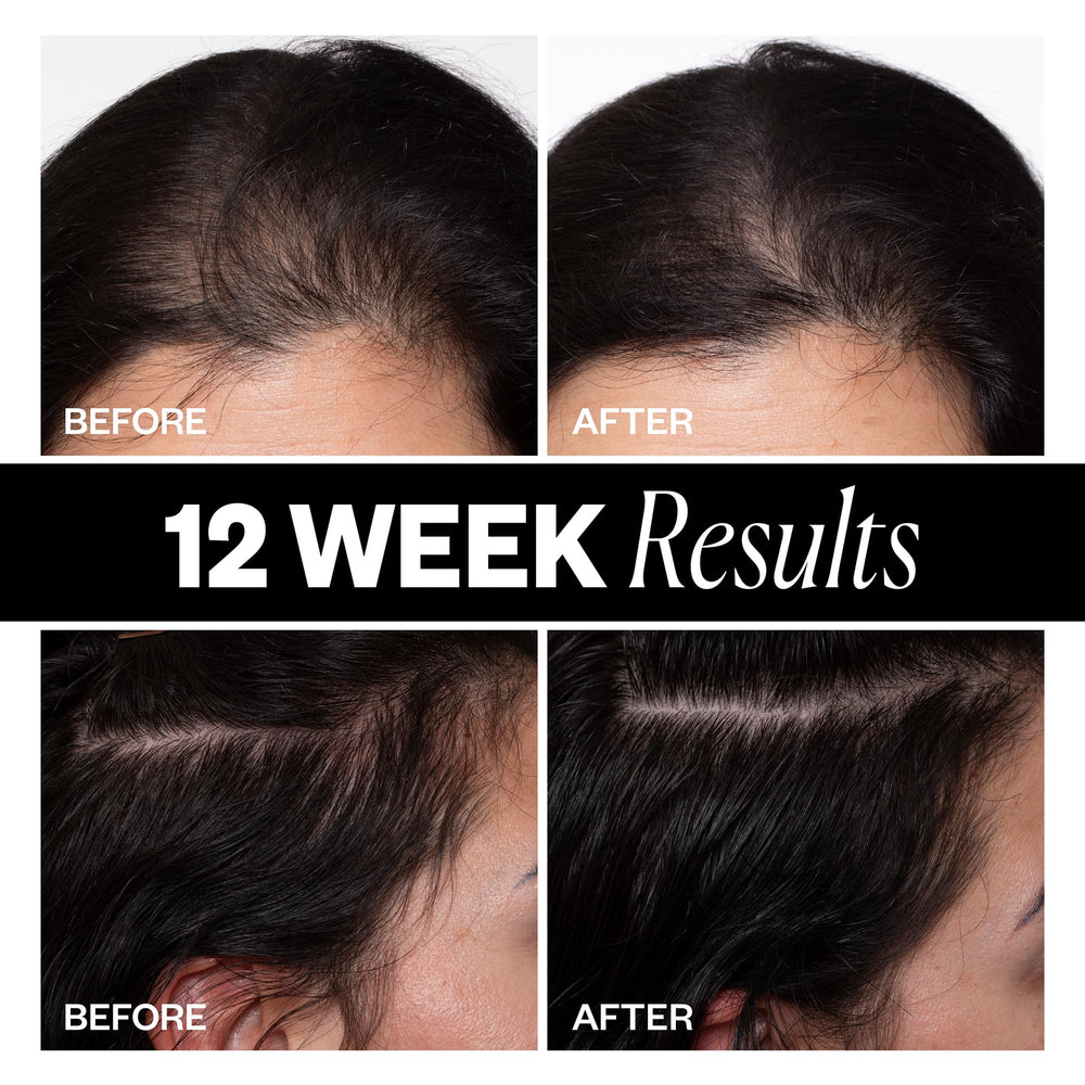 IGK biotin hair-boosting complex bottle detail suggests healthier-looking hair.