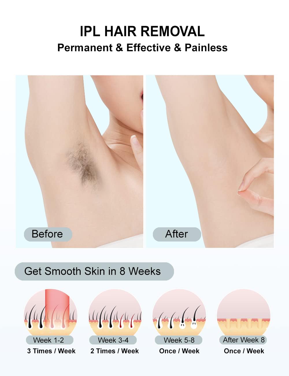 IIDEA IPL legs device for at home use, efficient full body treatment