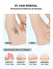 IIDEA IPL legs device for at home use, efficient full body treatment