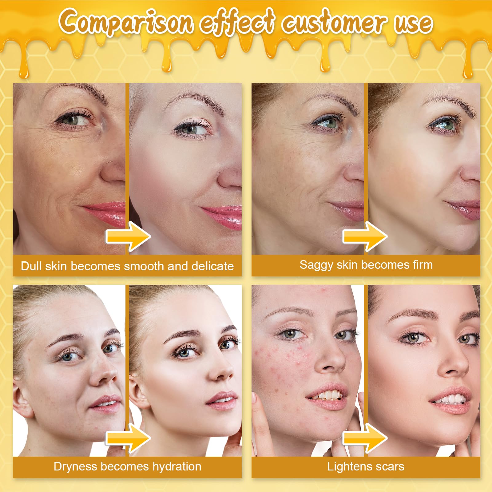 IIIMEIDU Bee Venom Skin Cream anti-blemish care for clearer-looking skin.