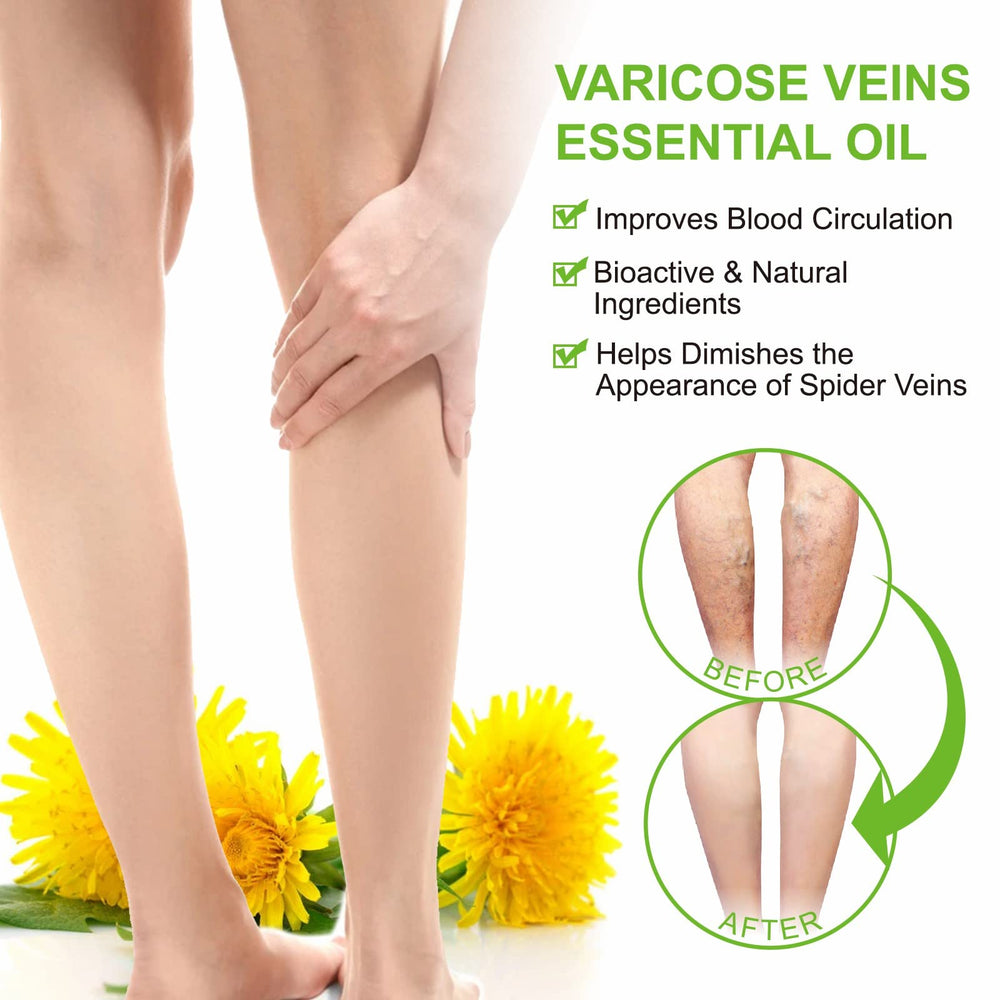 IKZEE Varicose Veins Essential Oil dropper for precise daily application