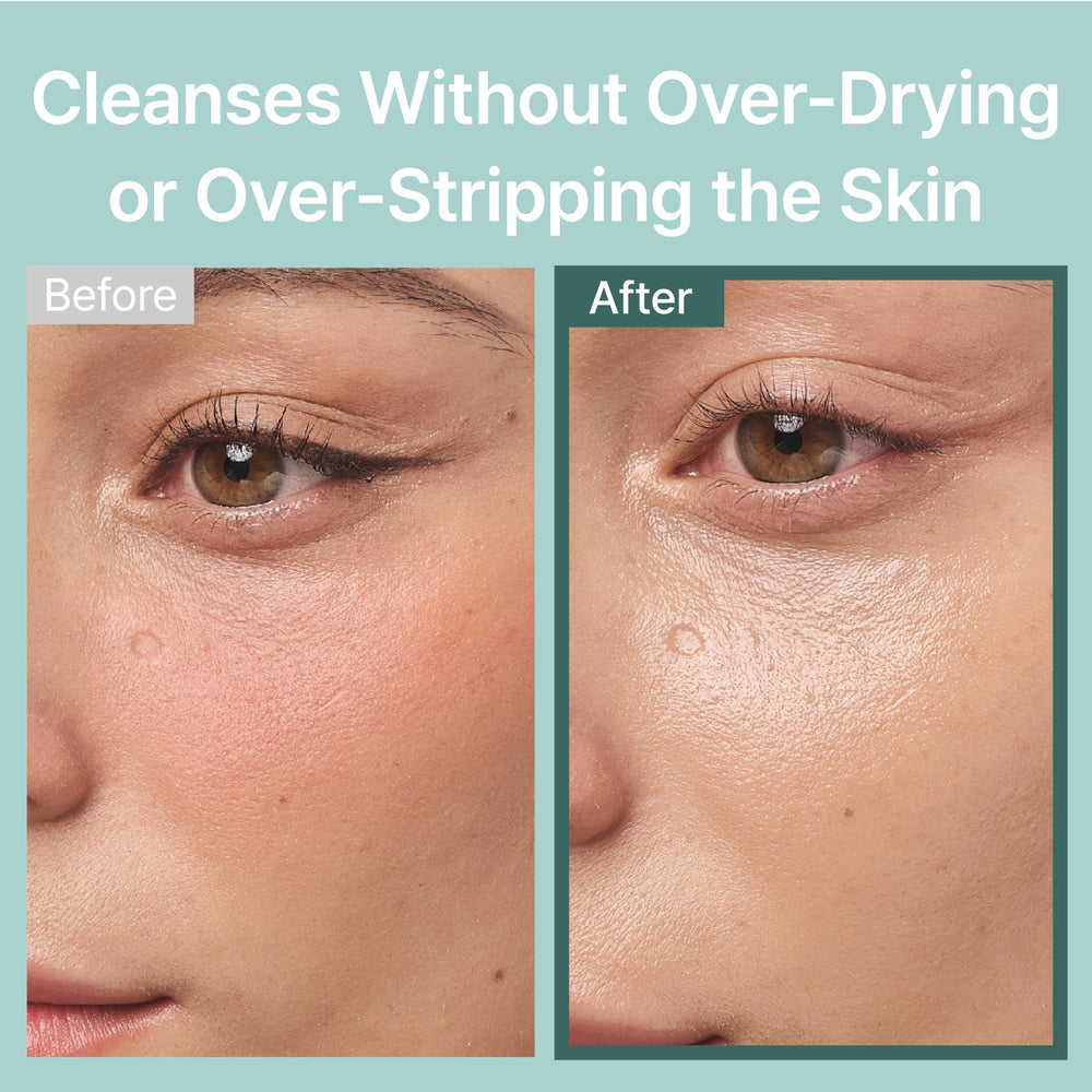 Illiyoon dermatologist-tested visual asserts skin safety for sensitive and acne-prone users