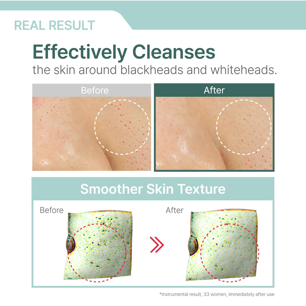 Illiyoon Gentle Deep Cleansing Oil on a porcelain dish, simple skincare ritual.
