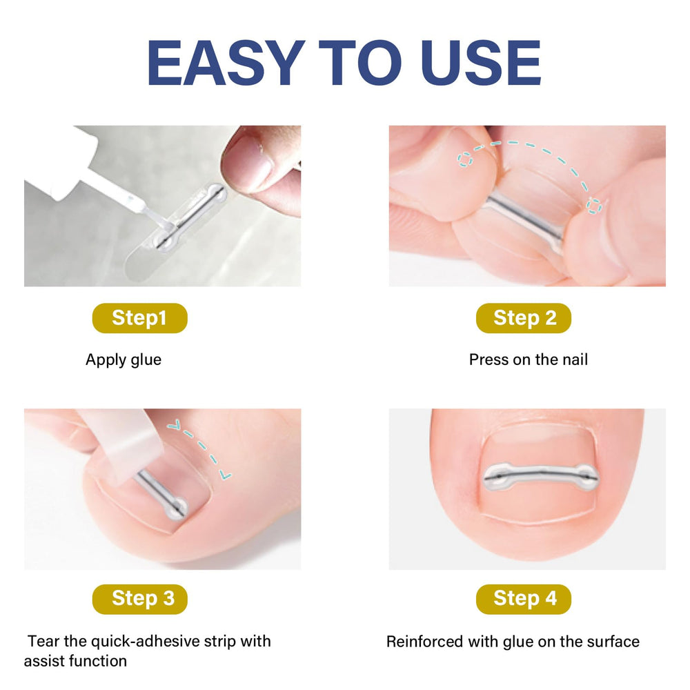 ITECFREELY multiple widths for personalized nail fit.