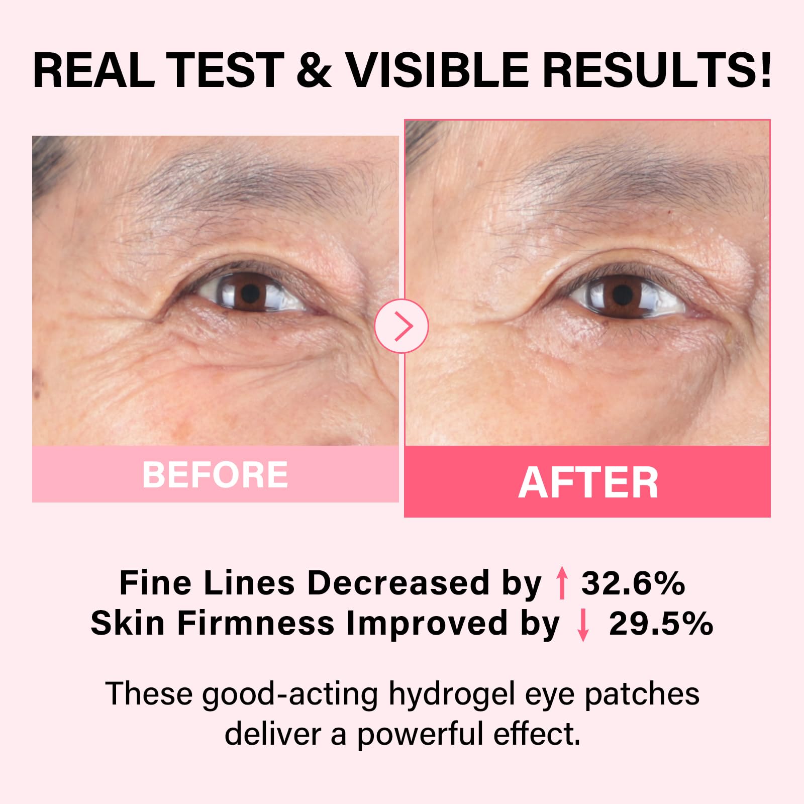 IMETHOD PDRN Eye Patch applied under-eye area to illustrate cool, calming relief.