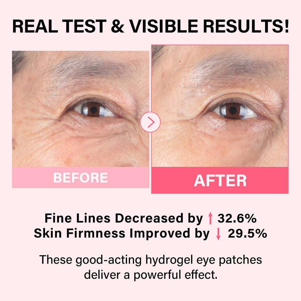 IMETHOD PDRN Eye Patch applied under-eye area to illustrate cool, calming relief.