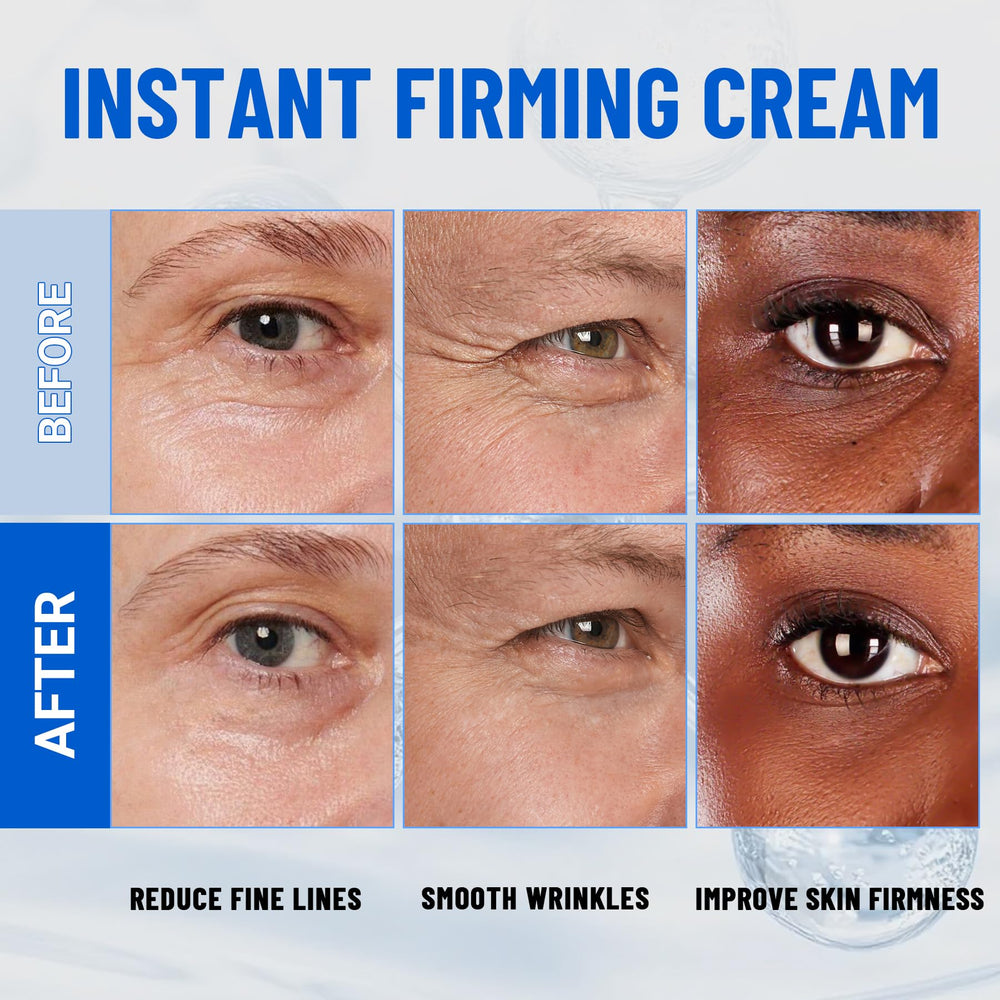 iMethod Perfection Eye Tightener close-up texture highlights moisturizing feel.
