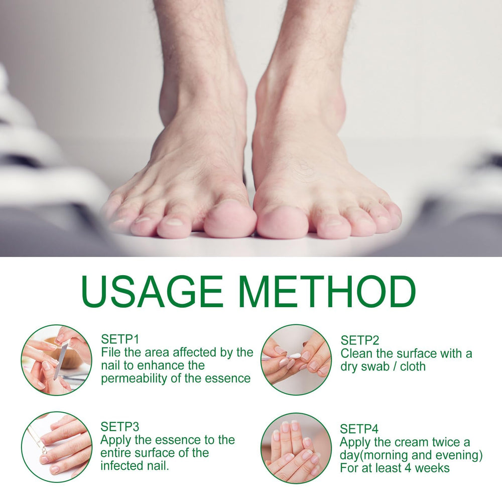 IMOLL Daily Nail Care Oil protects nail edges and surface moisture.