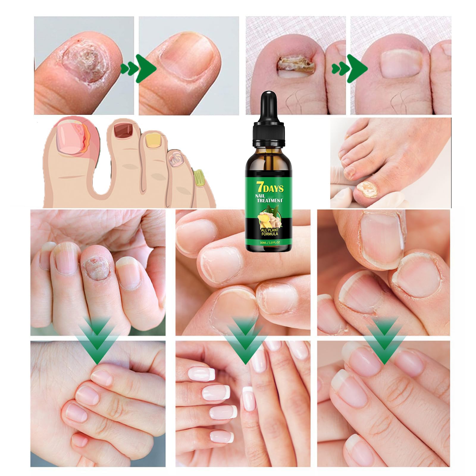 IMOLL Ginger Nail Growth Serum dropper prepares stronger-looking nails.