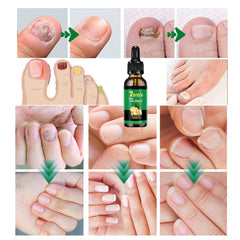 IMOLL Ginger Nail Growth Serum dropper prepares stronger-looking nails.