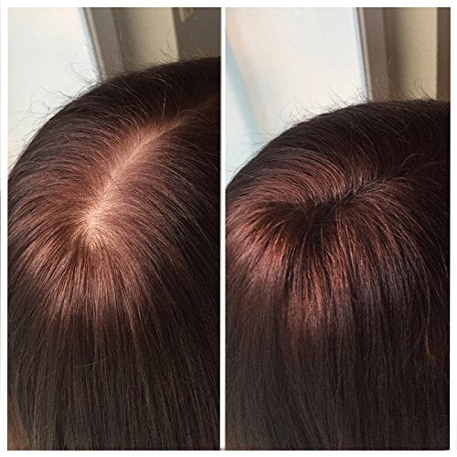 Imperio Hair Building Fibers dermatologically tested in Germany ensuring gentle use on skin