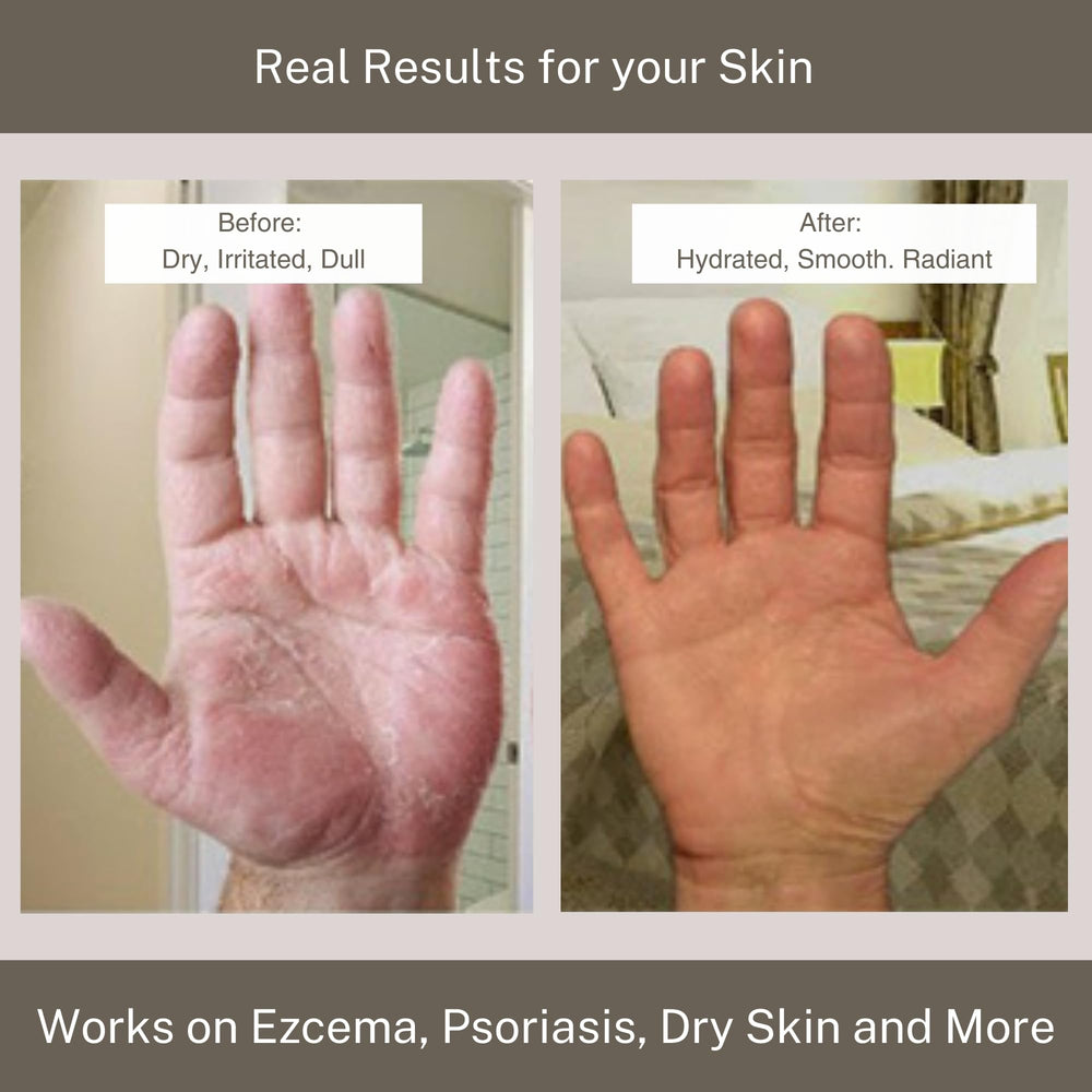 InfiniteAloe Skin after-use glow suggesting soft, hydrated skin all day