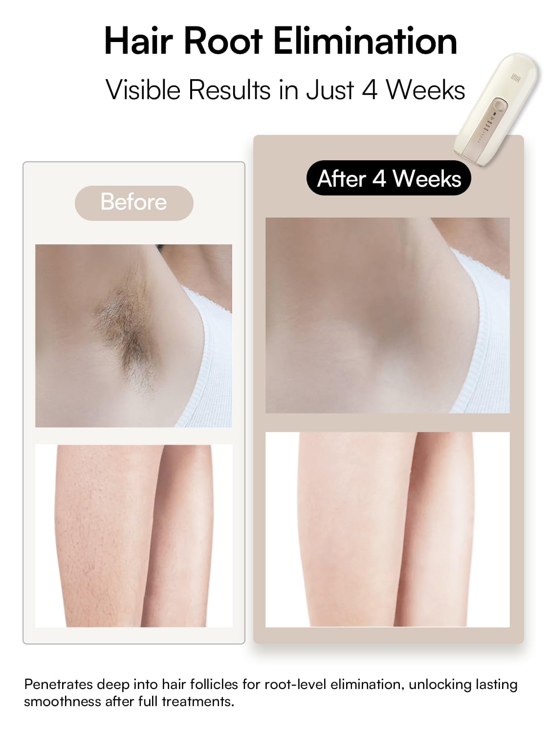 INIA Fond underarm mode demonstrates quick underarm treatments at home