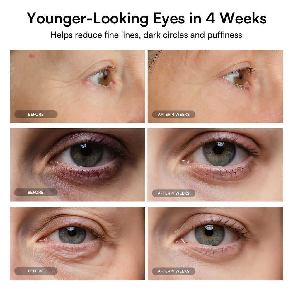 INIA red light eye mask demonstrates potential for reducing dark circles around eyes