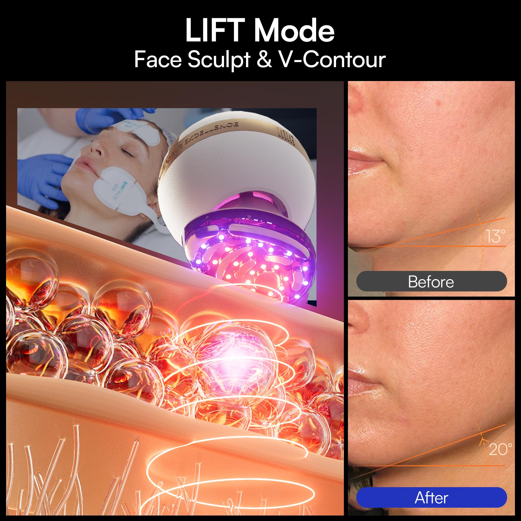 INIA SPHERA cryo cooling reduces puffiness for refreshed skin