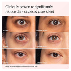 Packaging display of Innbeauty Project Bright & Tight Eye Cream emphasizing clean vegan formula