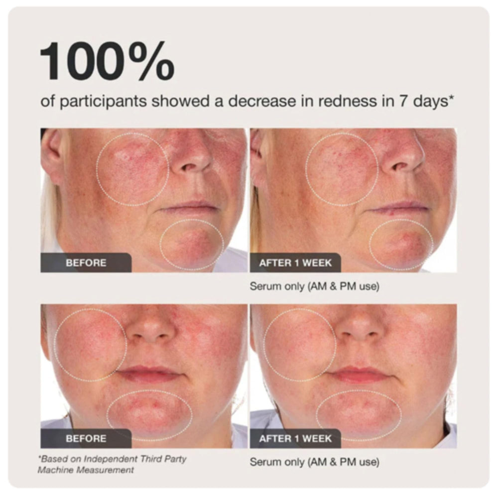 Innbeauty Project lightweight serum texture showing weightless, non-greasy finish on skin.