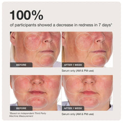 Innbeauty Project lightweight serum texture showing weightless, non-greasy finish on skin.