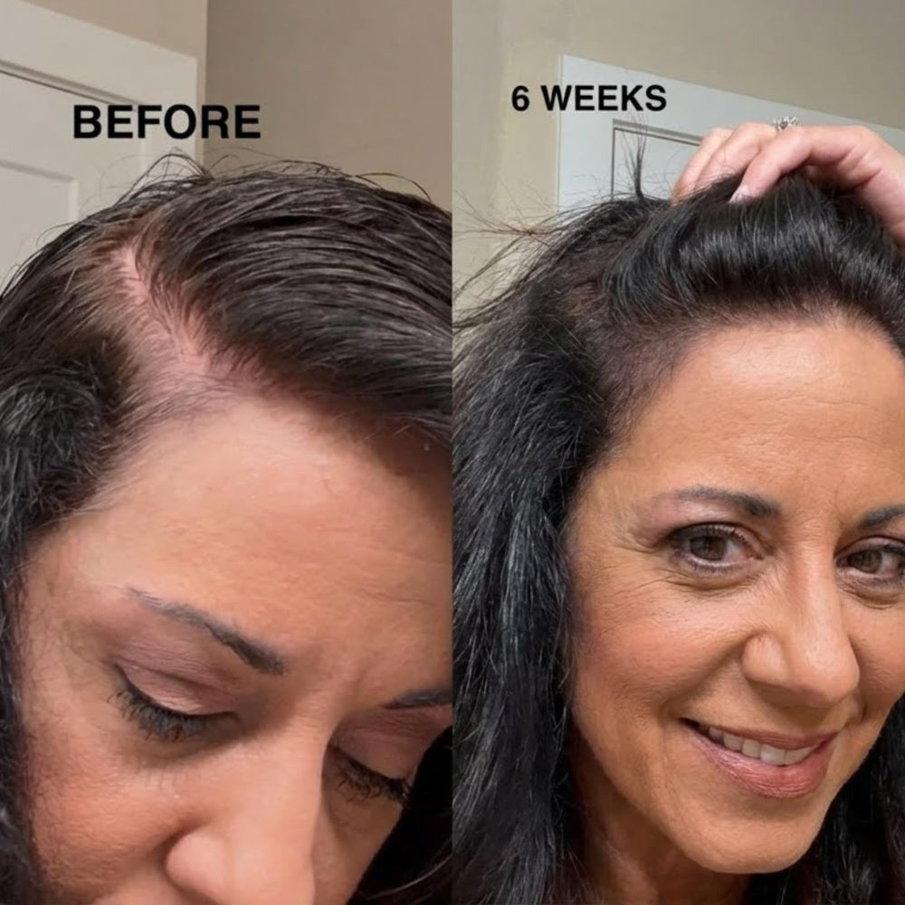 Innerbloom minoxidil application on scalp demonstrating targeted treatment.